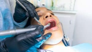 dental extractions and minor surgeries