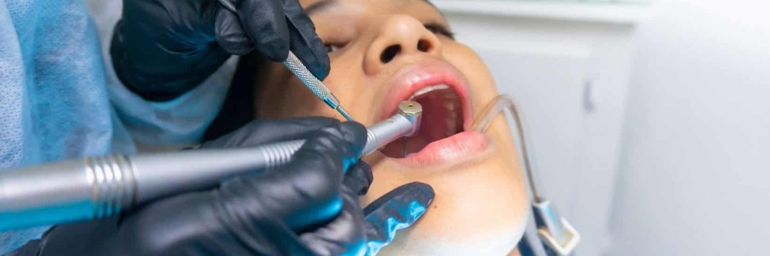 dental extractions and minor surgeries