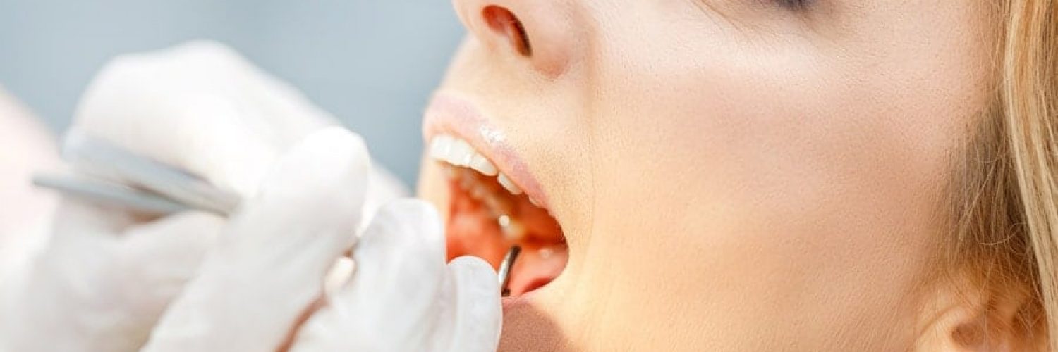 Woman Undergoing Regular Dental Cleaning