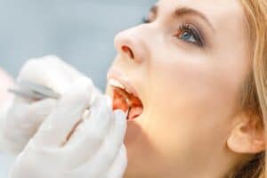 Woman Undergoing Regular Dental Cleaning